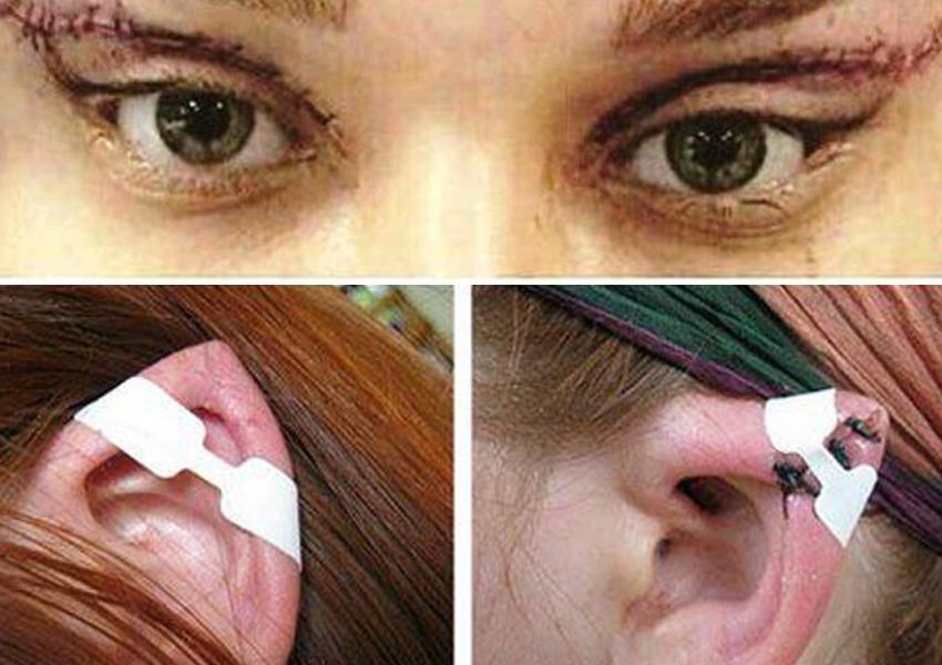 Prison and Flogging for “Cat Eye” and “Donkey Ear” Plastic Surgeries